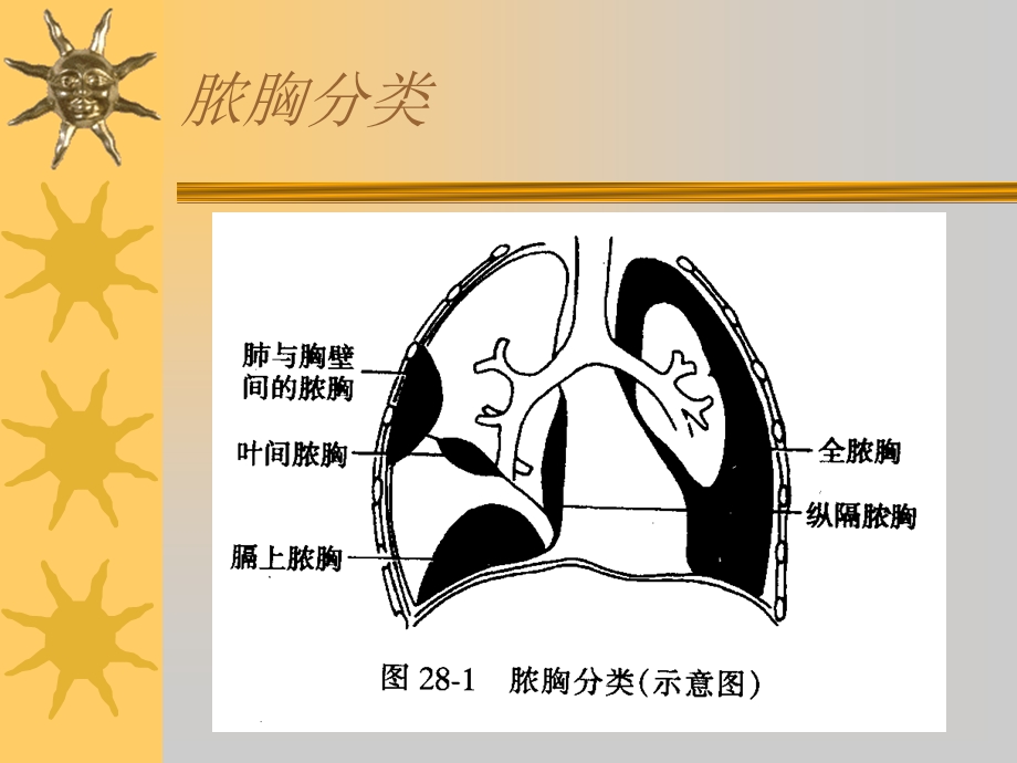 医学课件外科学各论04脓胸.ppt_第3页