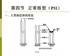 医学遗传学染色体病课件.ppt