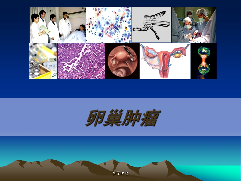 卵巢肿瘤医学课件PPT课件.ppt_第1页