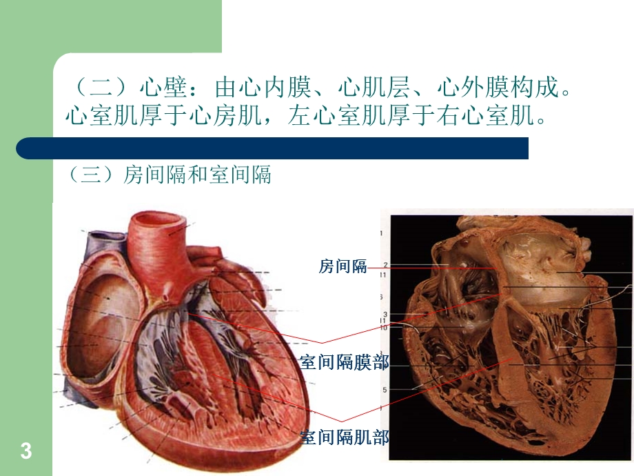 心脏粘液瘤医学PPT课件.ppt_第3页