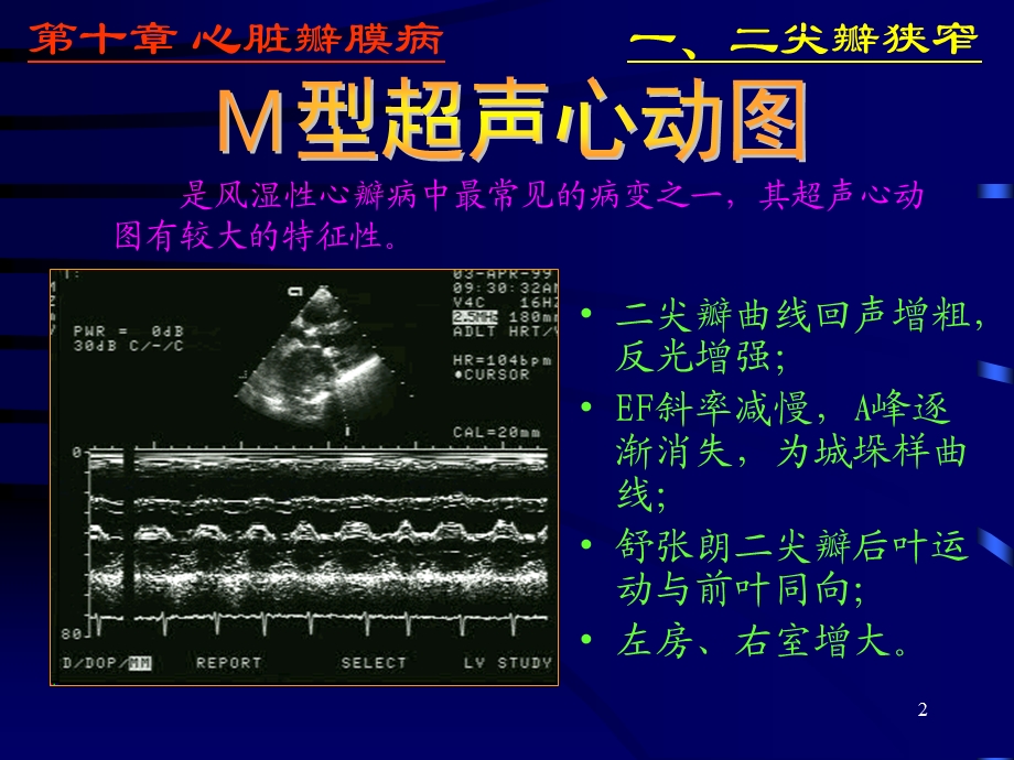 心脏彩超诊断医学PPT课件.ppt_第2页