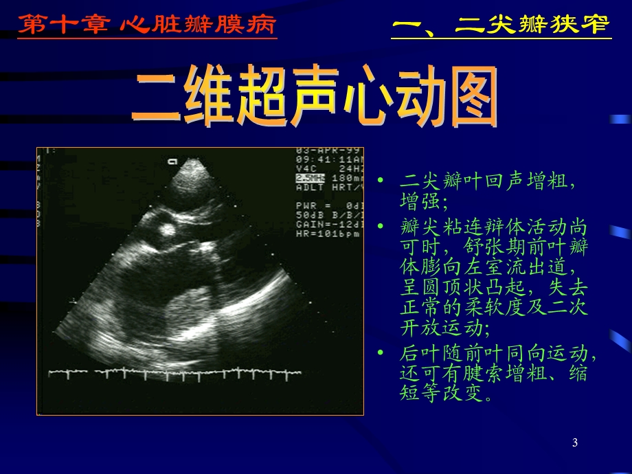 心脏彩超诊断医学PPT课件.ppt_第3页