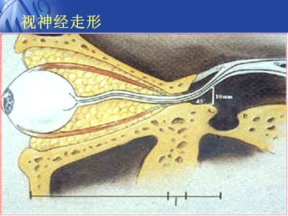 视神经疾病(医学PPT课件).ppt_第3页