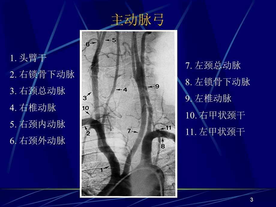 脑血管解剖及造影术PPT医学课件.ppt_第3页