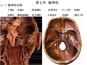 脑神经(解剖生理学).ppt