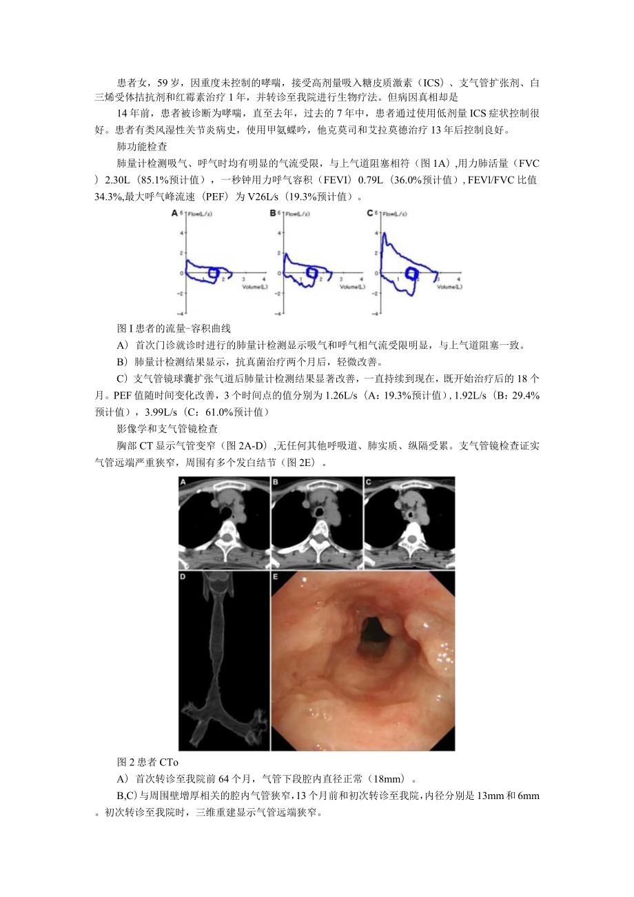 59岁女性患哮喘14年最近症状不能控制真实原因并不简单（附哮喘可以控制但不能根治）.docx_第1页