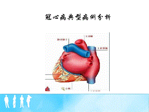 冠心病典型病例.pptx