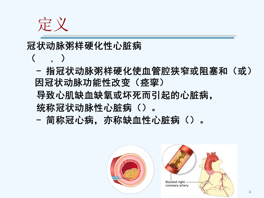 冠心病与介入治疗.pptx_第2页