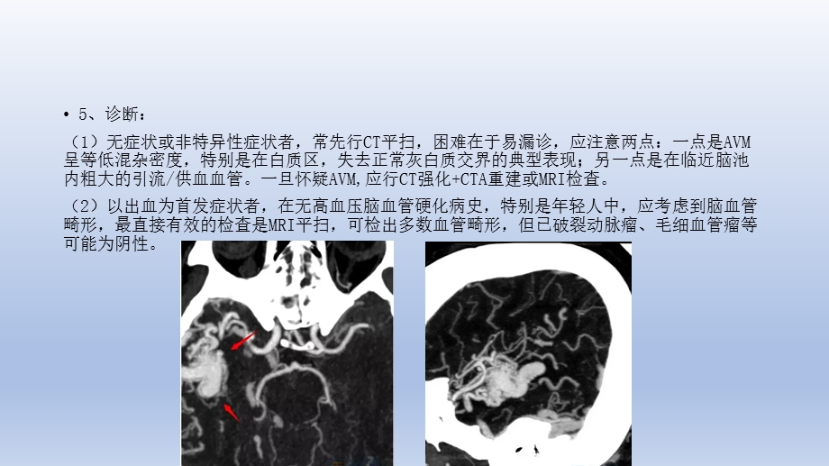 常见脑血管畸形的影像学表现.pptx_第3页