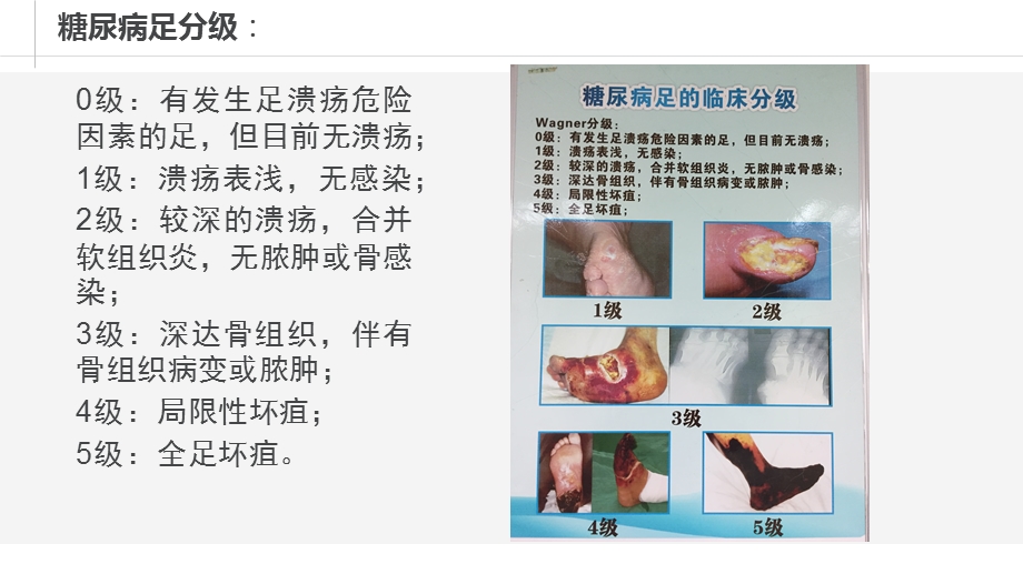 糖尿病足个案.pptx_第3页