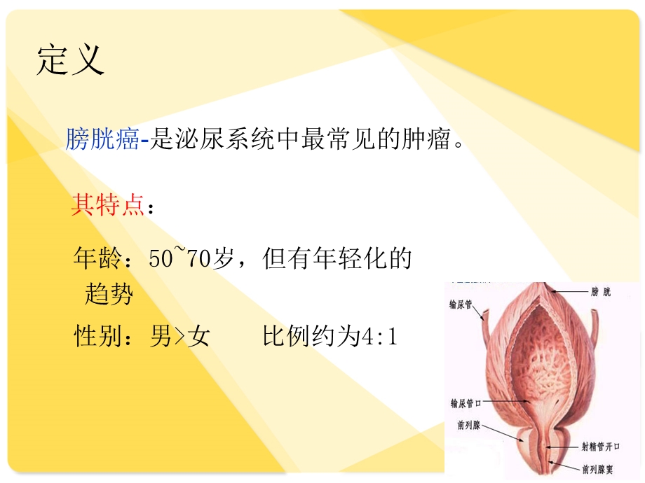 膀胱癌护理医学PPT课件.pptx_第3页