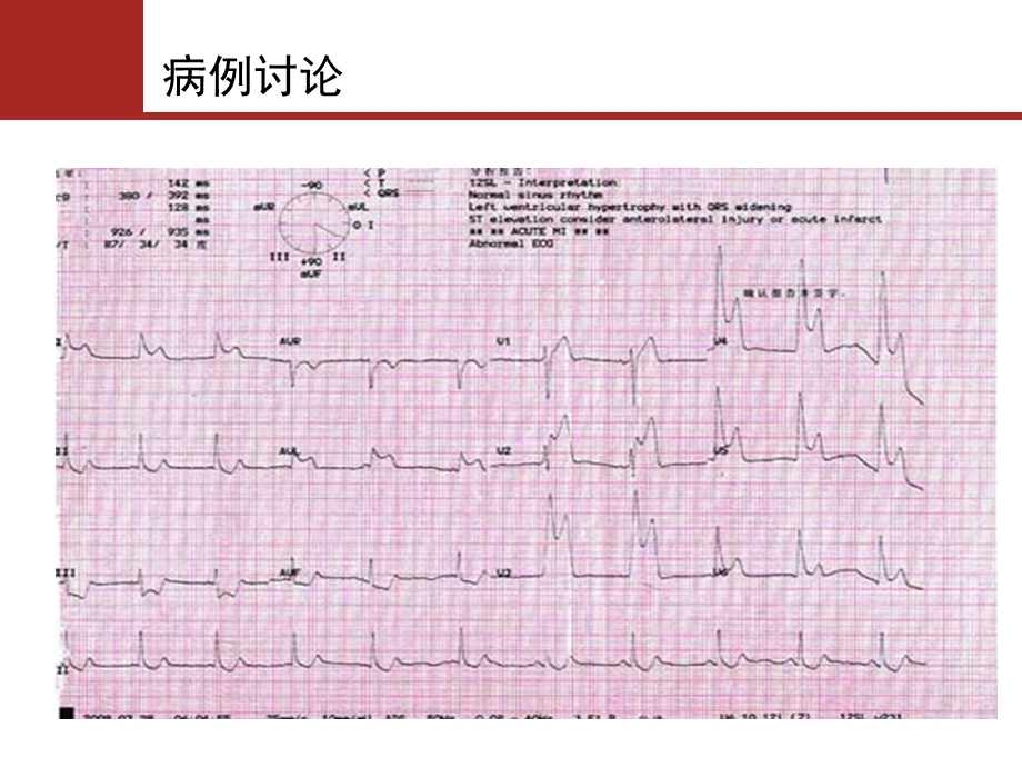 高血压急诊指南.pptx_第3页