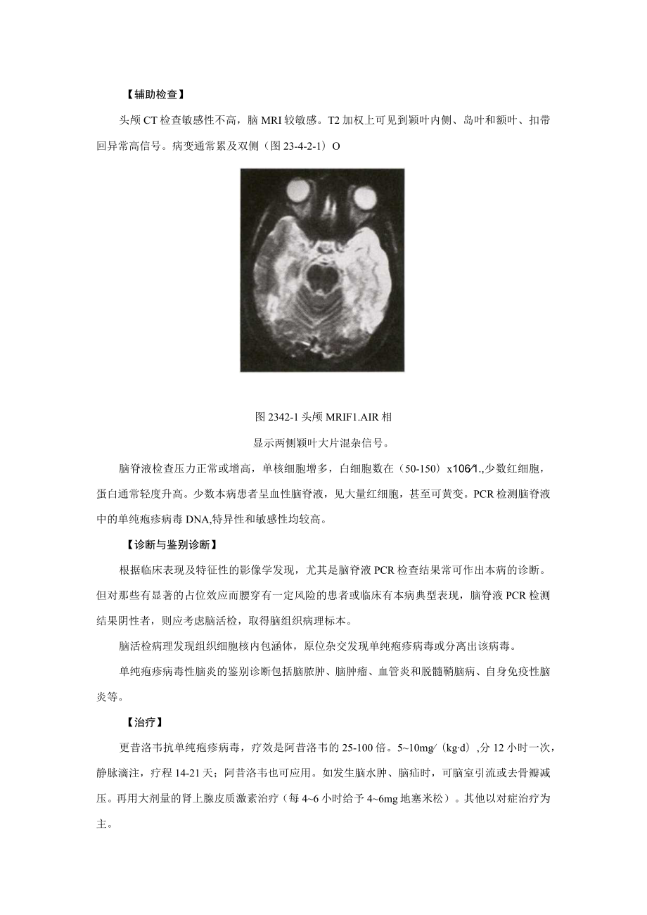 单纯疱疹病毒性脑炎诊疗规范2023版.docx_第2页