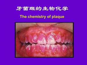 牙菌斑的生物化学.pptx