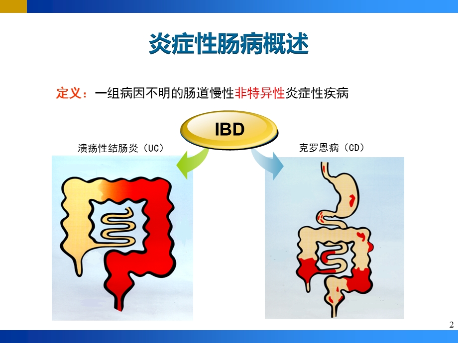 炎症性肠病(IBD)PPT.pptx_第2页