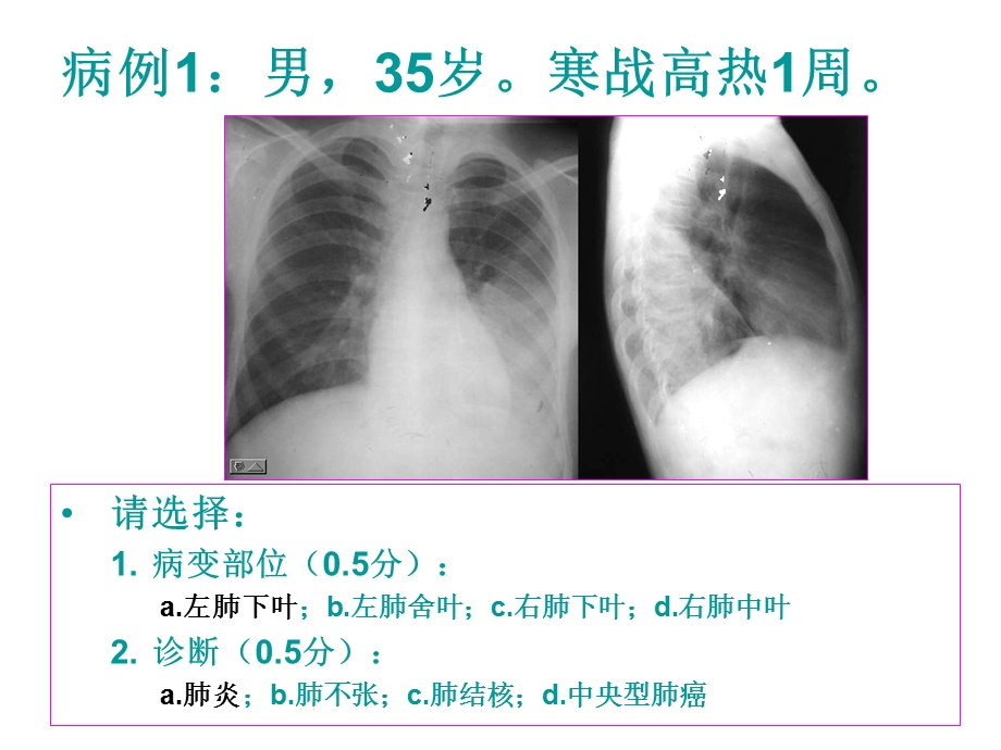 医师资格考试技能影像试题.ppt_第2页