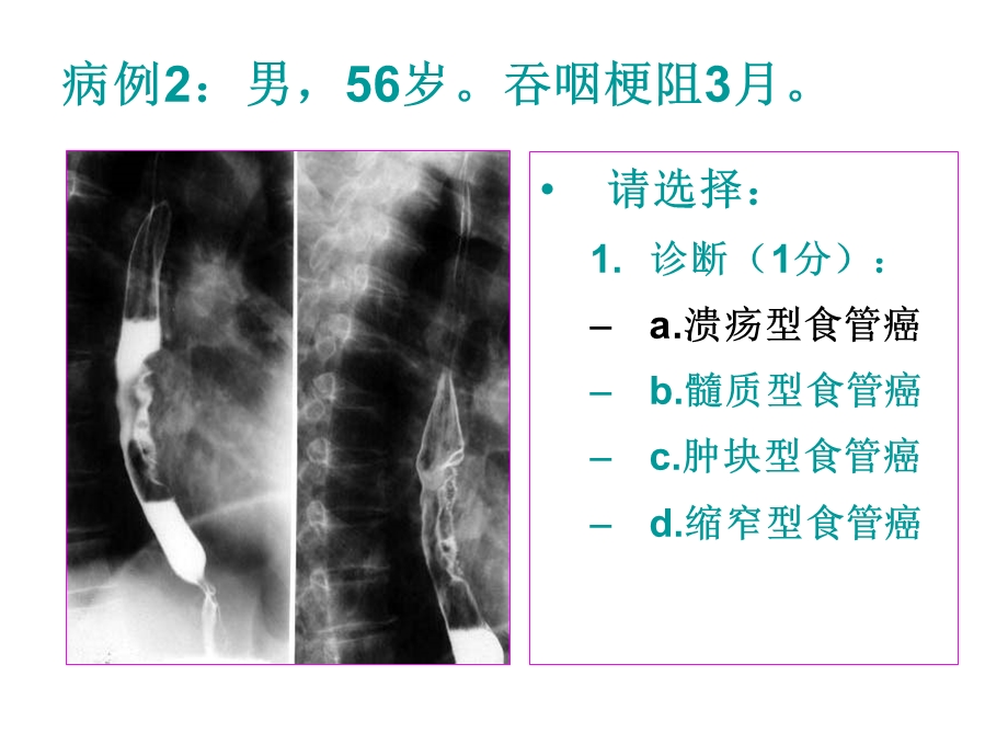 医师资格考试技能影像试题.ppt_第3页