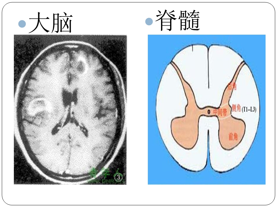 神经调节的基本方式.ppt.ppt_第3页