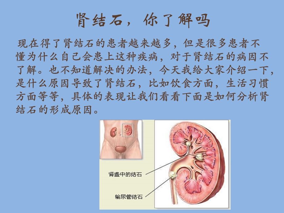 肾结石是怎么形成的.ppt_第2页