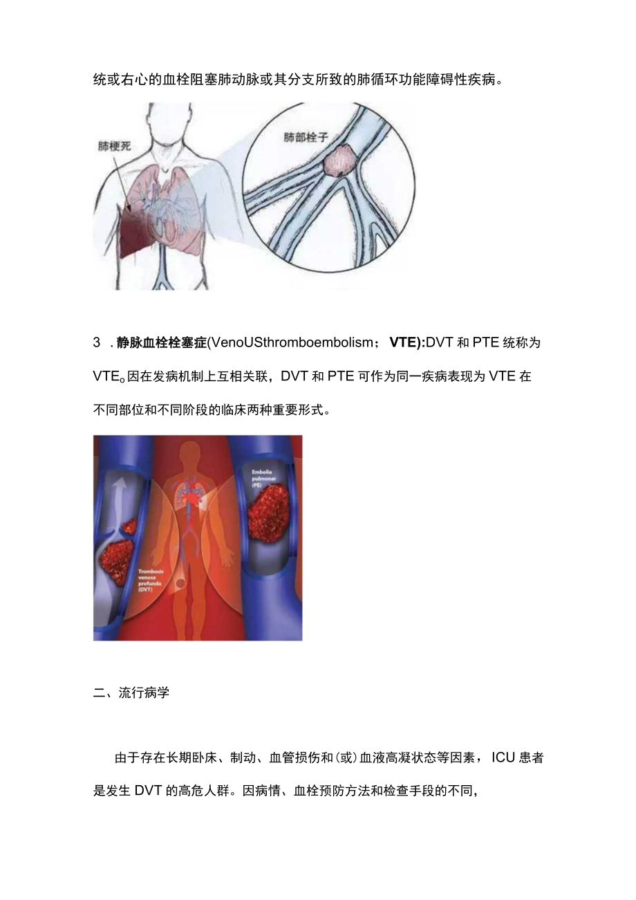 2023年ICU患者深静脉血栓形成预防指南（完整版）.docx_第2页