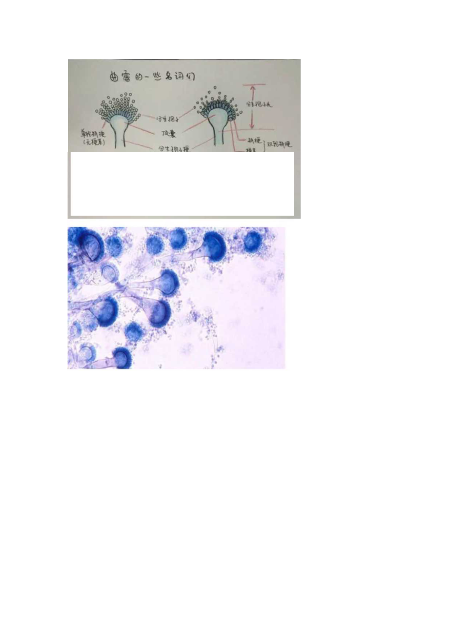 2023曲霉病科普知识（完整版）.docx_第2页