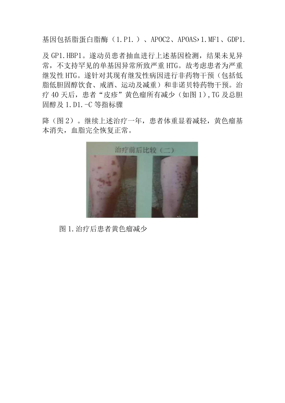 心内科医师晋升副主任（主任）医师高级职称病例分析专题报告（继发性高甘油三酯血症病例）.docx_第3页