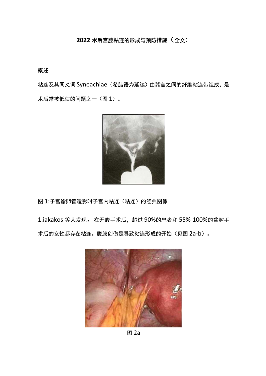 2022术后宫腔粘连的形成与预防措施（全文）.docx_第1页