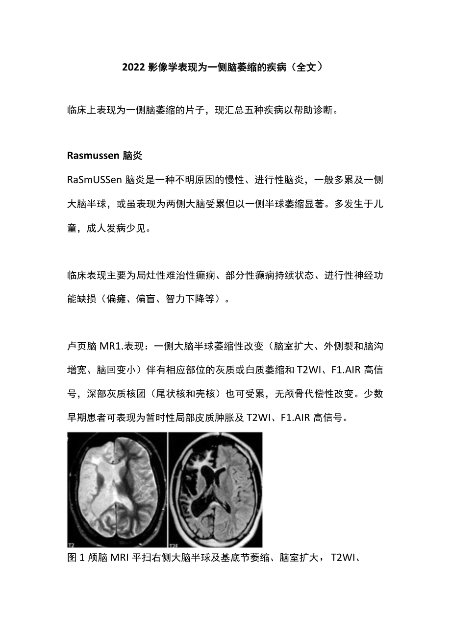 2022影像学表现为一侧脑萎缩的疾病（全文）.docx_第1页