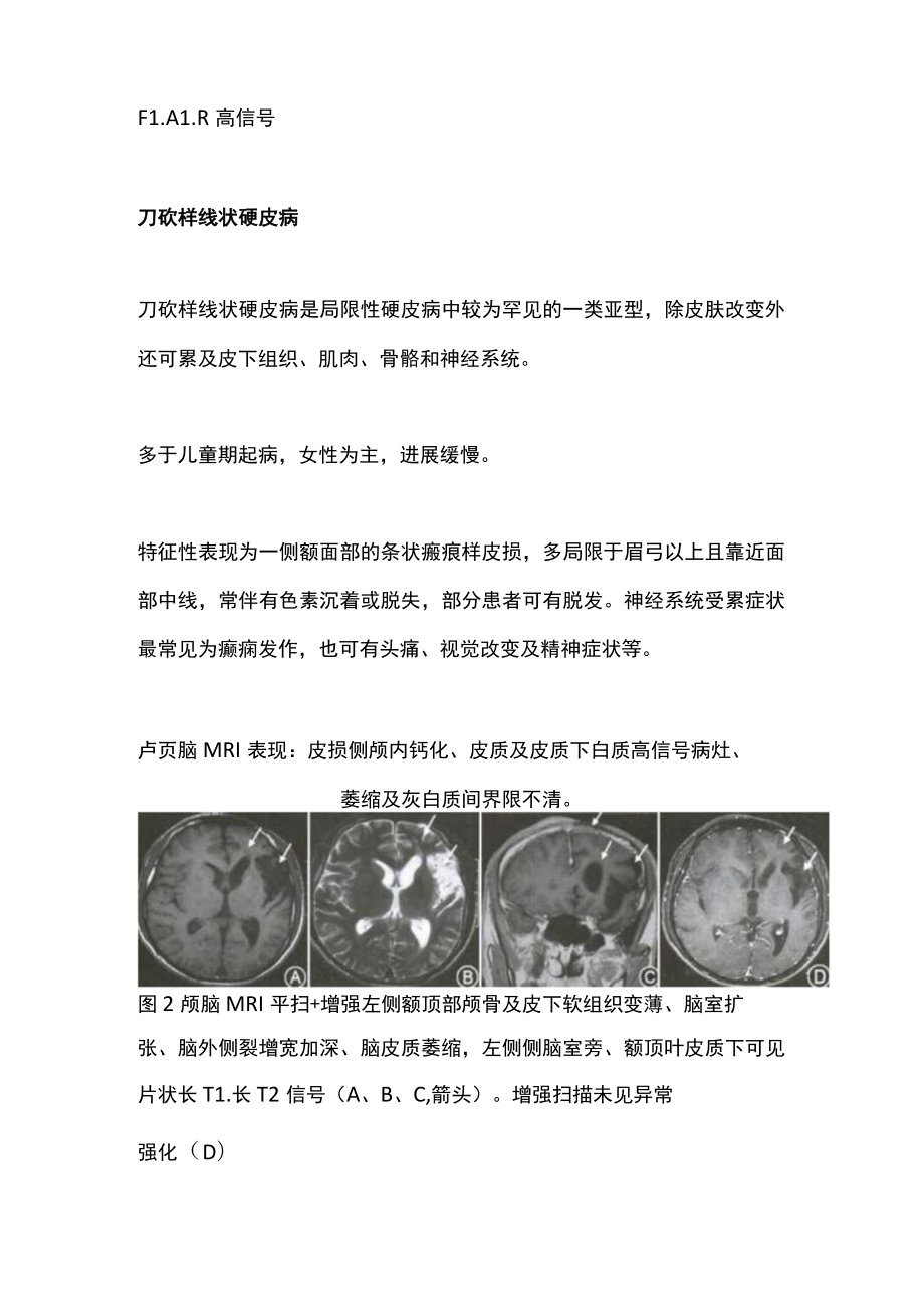 2022影像学表现为一侧脑萎缩的疾病（全文）.docx_第2页