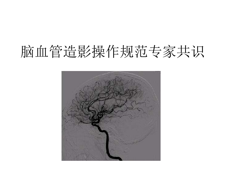 脑血管造影指南解读.ppt_第1页