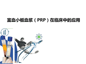 PRP的临床应用张咸伟.pptx