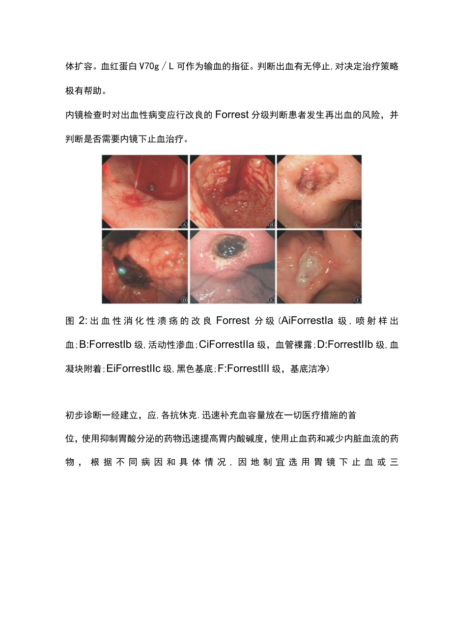 急性上消化道出血处理流程图（全文）.docx_第3页