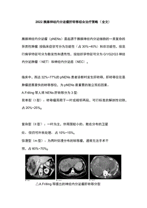 胰腺神经内分泌瘤肝转移综合治疗策略（全文）.docx