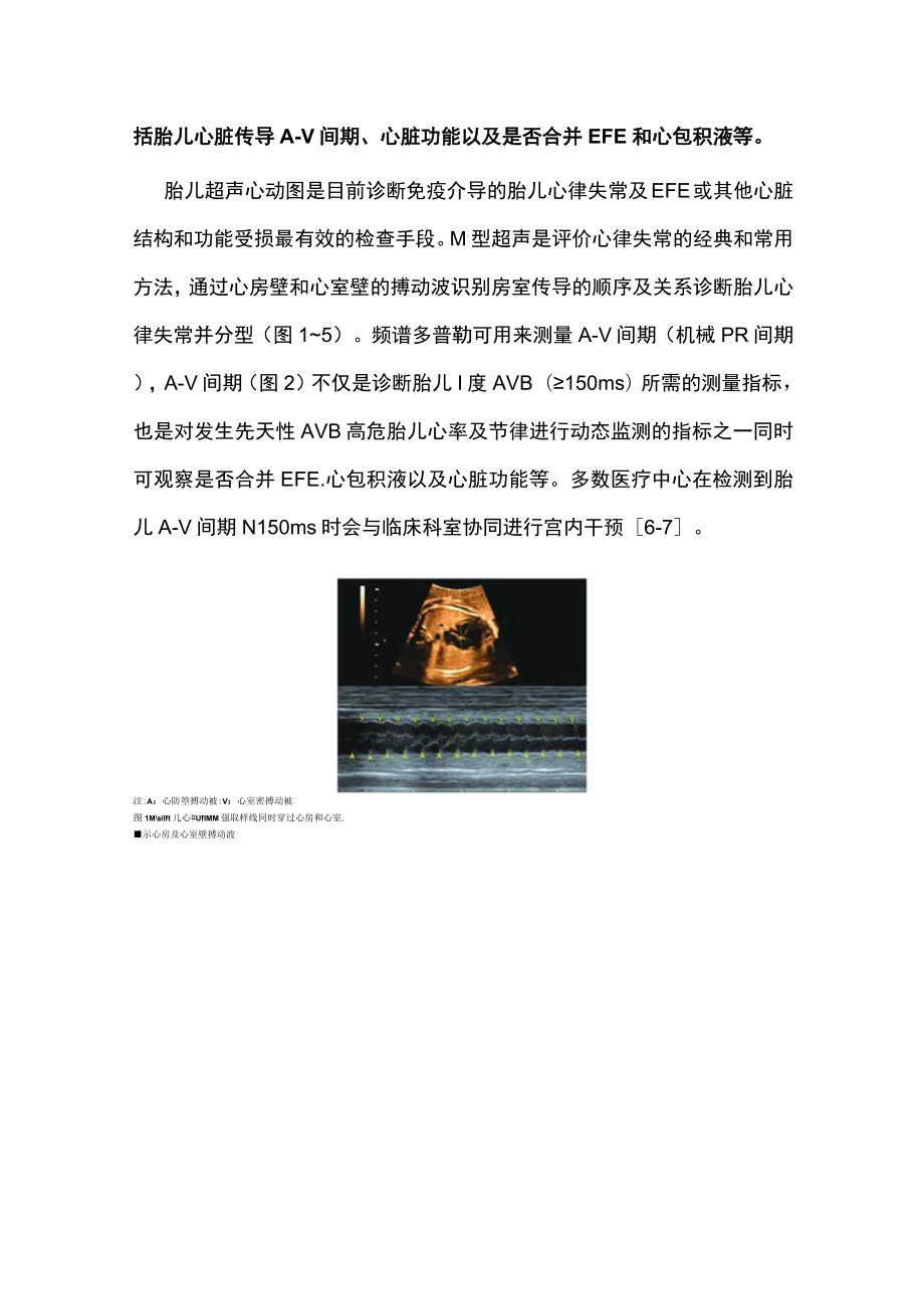 母体自身免疫性疾病和糖尿病胎儿心脏病围产期管理（全文）.docx_第3页