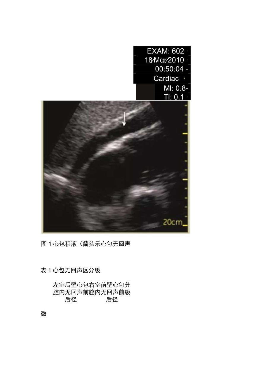 2023床旁超声在急危重症临床应用的专家共识（完整版）.docx_第2页