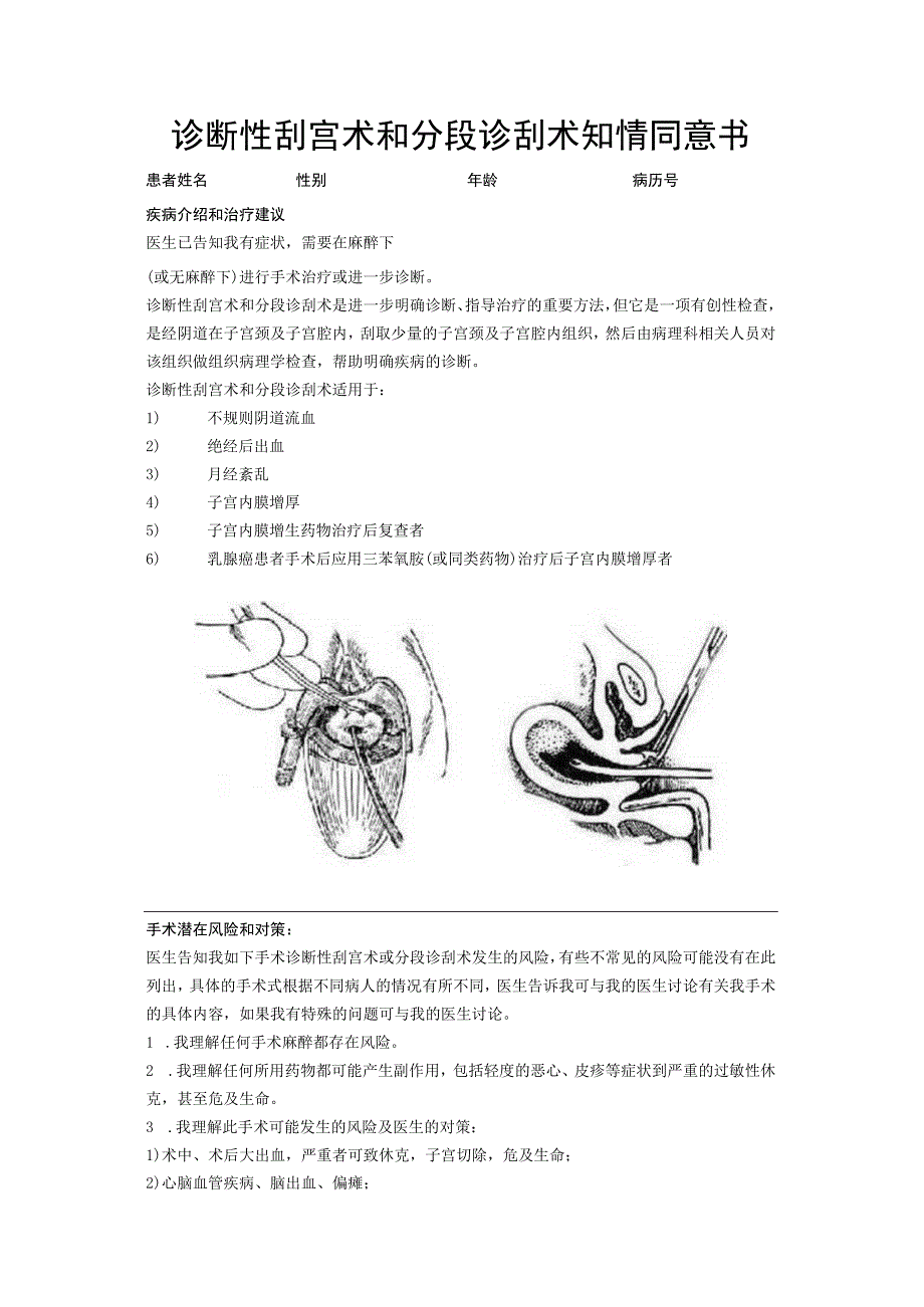 诊断性刮宫术和分段诊刮术知情同意书.docx_第1页