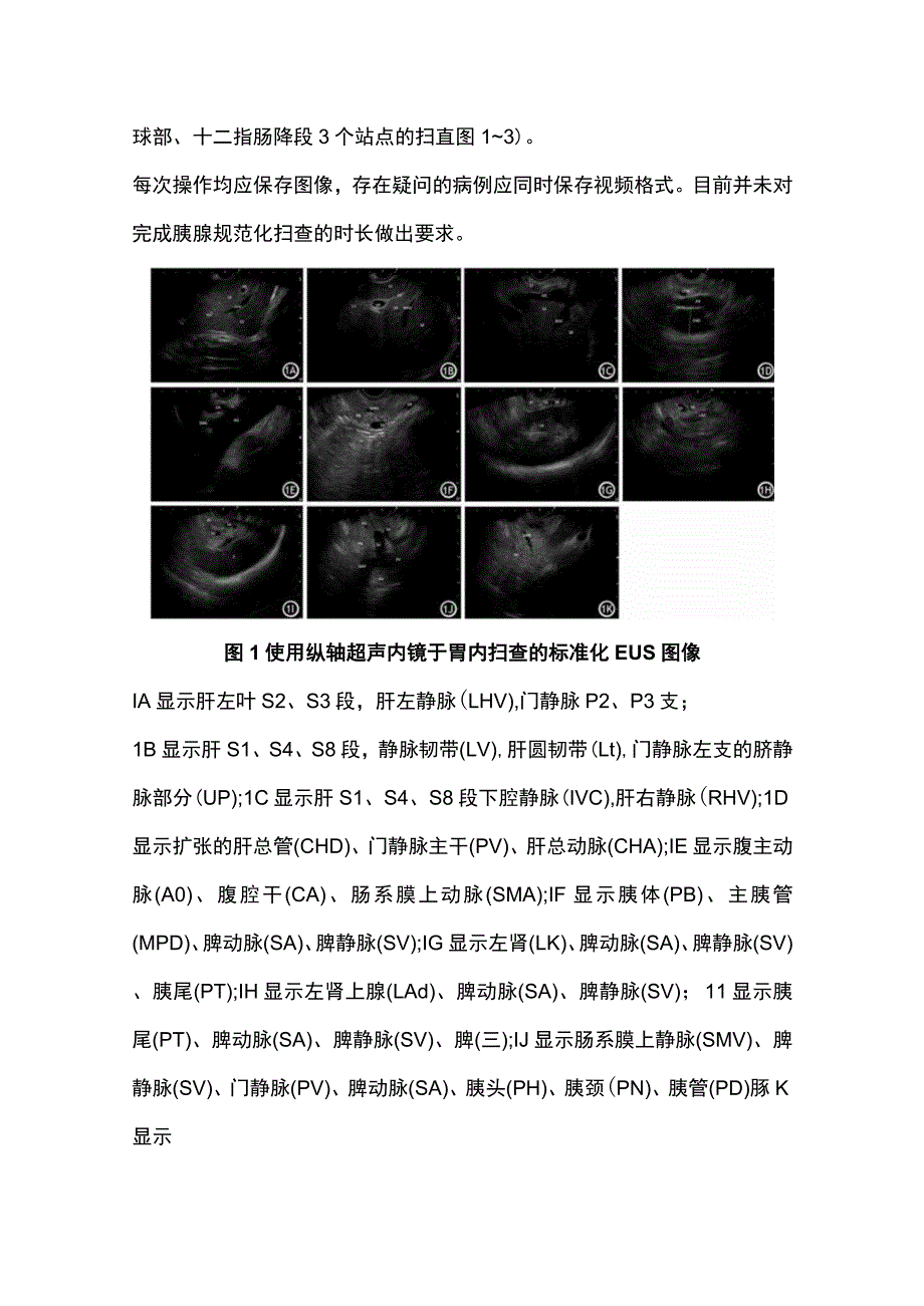 2023胰腺癌高危人群超声内镜标准化图像和报告的制定意见解读.docx_第2页