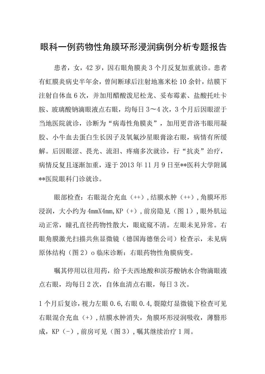 眼科一例药物性角膜环形浸润病例分析专题报告.docx_第1页