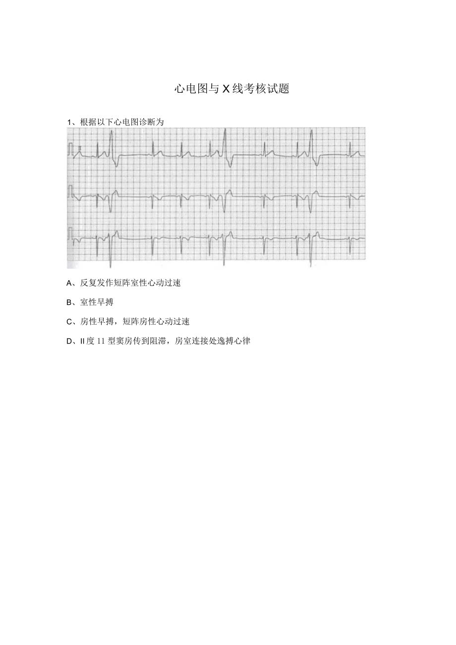 心电图与X线考核试题 .docx_第1页