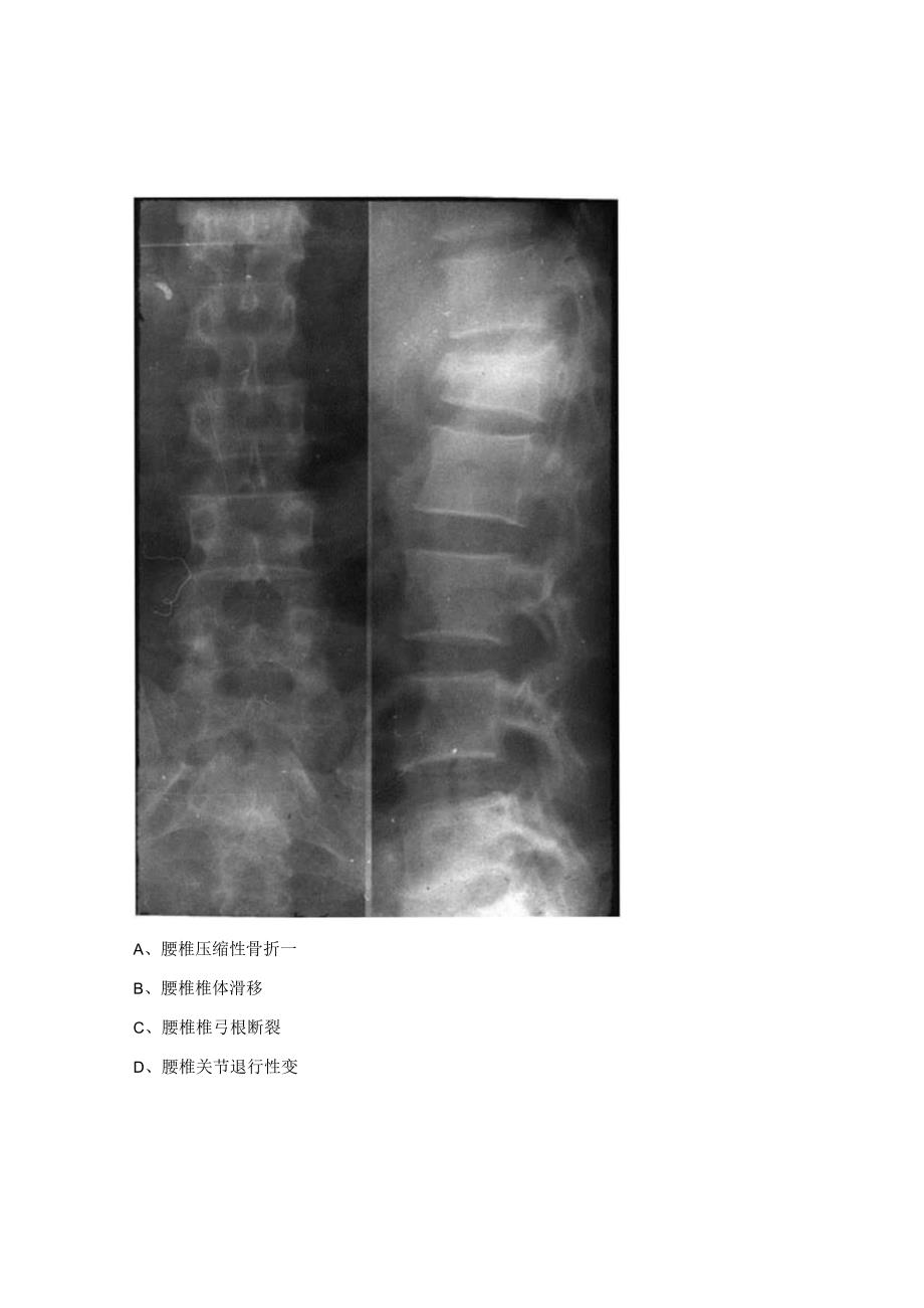 心电图与X线考核试题 .docx_第2页