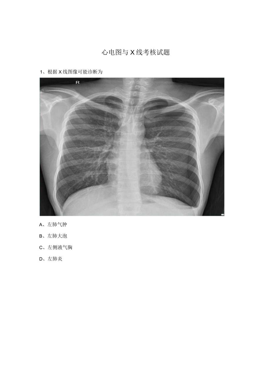 心电图与X线考核试题.docx_第1页