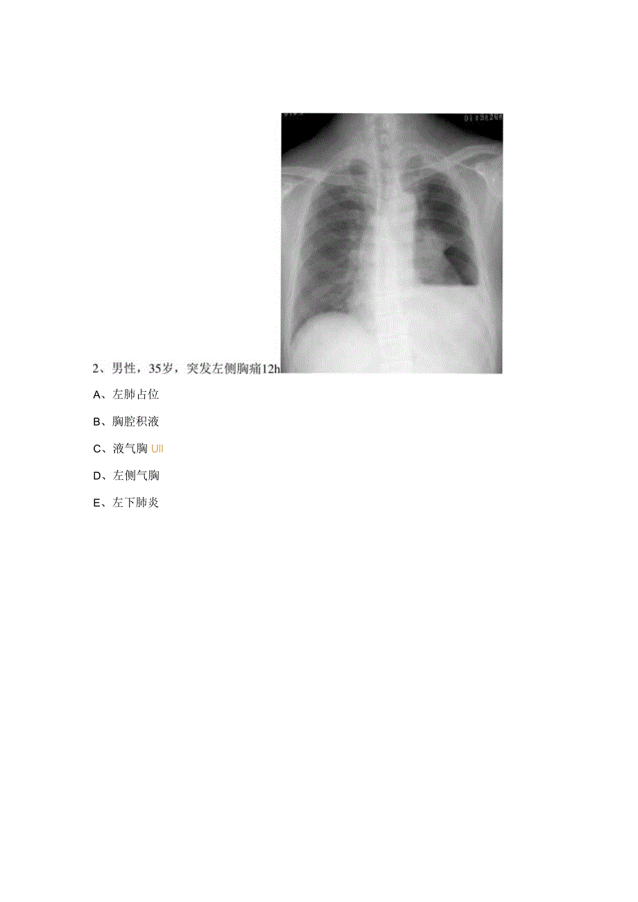 心电图与X线考核试题.docx_第2页