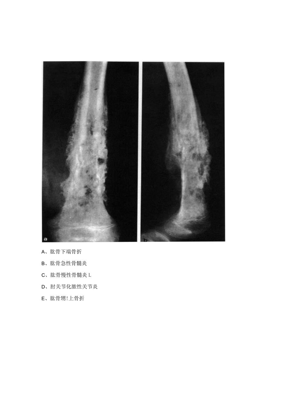 心电图与X线考核试题.docx_第3页