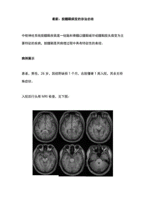 最新：脱髓鞘病变的诊治总结.docx