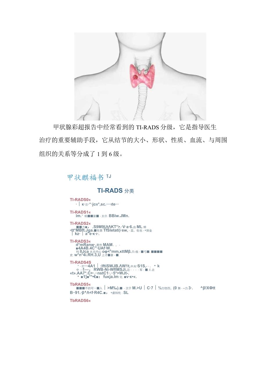 甲状腺结节科普知识介绍.docx_第2页