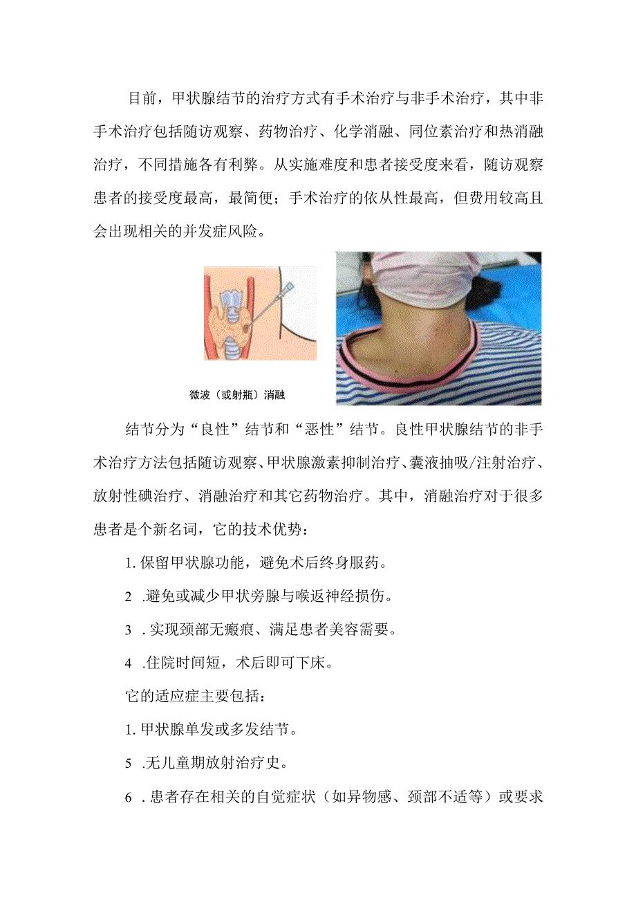 甲状腺结节科普知识介绍.docx_第3页