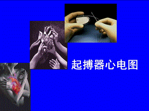 起搏器心电图.ppt