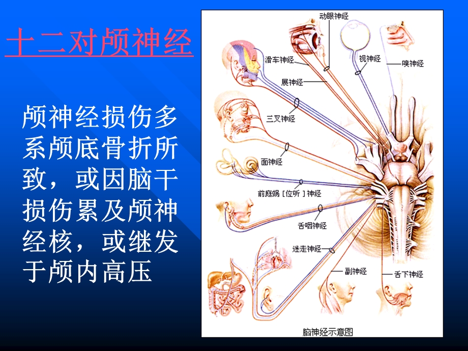 颅脑损伤合并颅神经损伤的临床表现.ppt_第2页