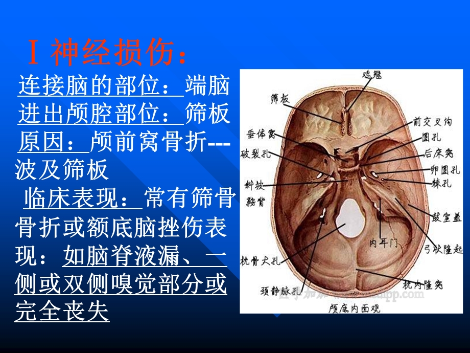 颅脑损伤合并颅神经损伤的临床表现.ppt_第3页