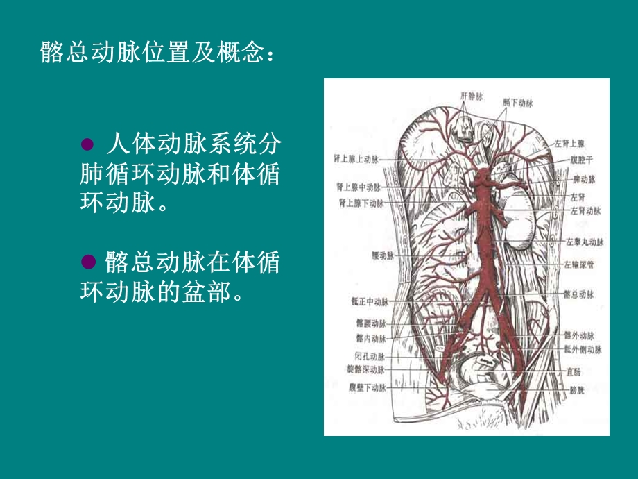 髂总动脉闭塞.ppt_第2页